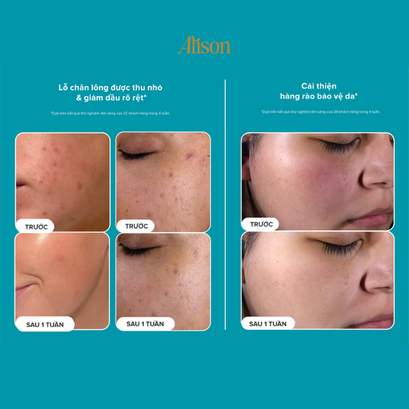 Paula’s Choice Skin Perfecting 2% BHA Liquid Exfoliant